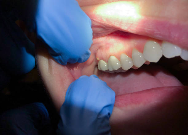 Best After-Hours Dental Trauma Care in Hallettsville, TX