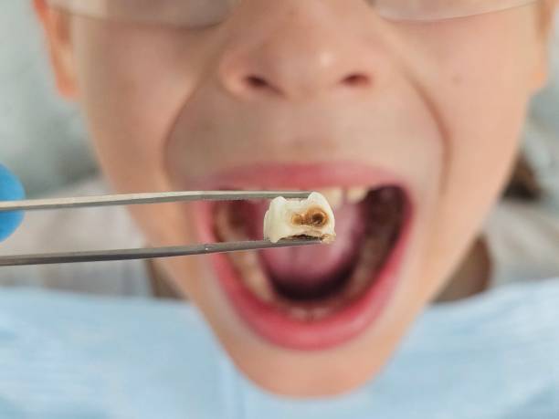 Best Cosmetic Emergency Dentistry in Hallettsville, TX