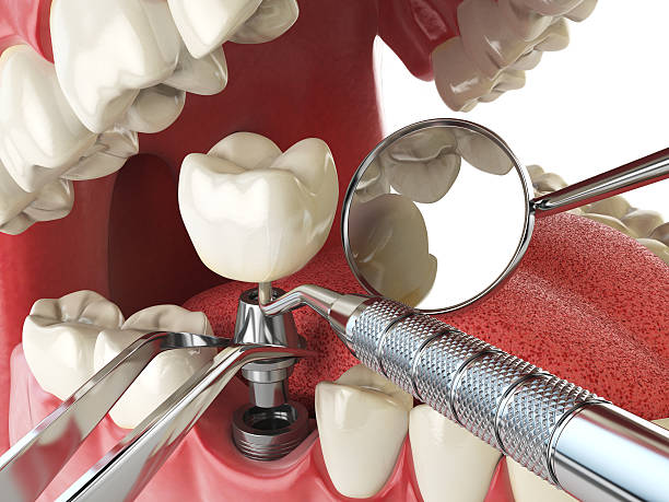 Best Emergency Denture Repair in Hallettsville, TX